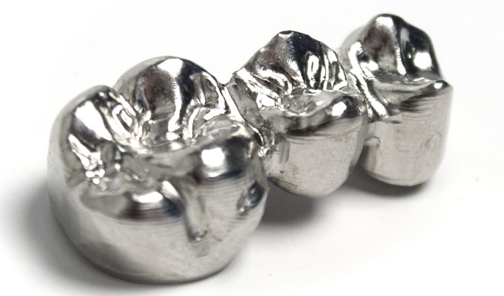 Dental Bridges 3 Full Metal Cast