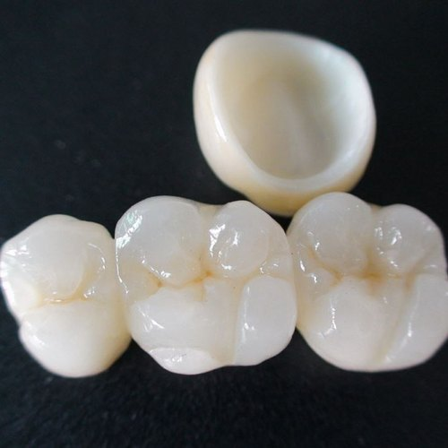 Dental Bridges 7 Zirconia Bridge