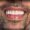 Close-up of a mouth of a smiling man to show his Crowns to help illustrate what is restorative dentistry