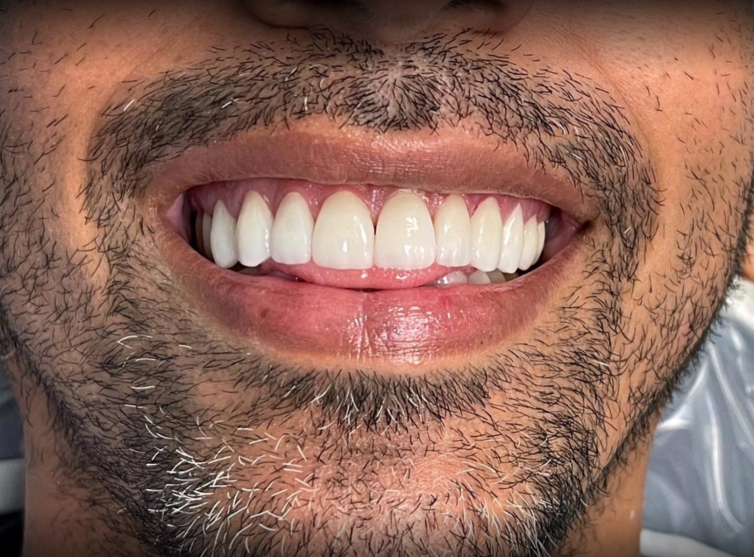 teeth, dental, tooth