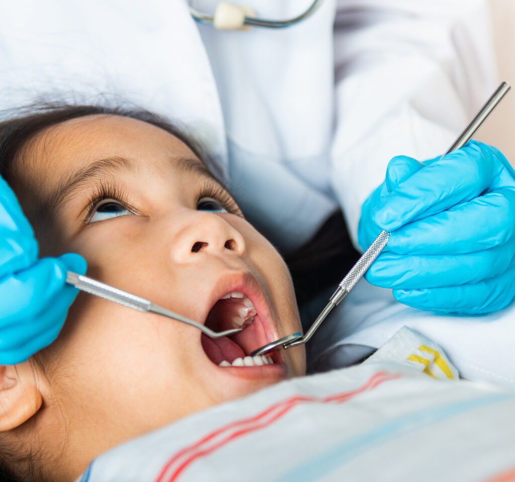 Doctor examines oral cavity of little child uses mouth mirror to checking teeth cavity to help illustrate Pediatric Restorative Dentistry