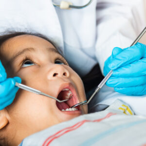 Doctor examines oral cavity of little child uses mouth mirror to checking teeth cavity to help illustrate Pediatric Restorative Dentistry