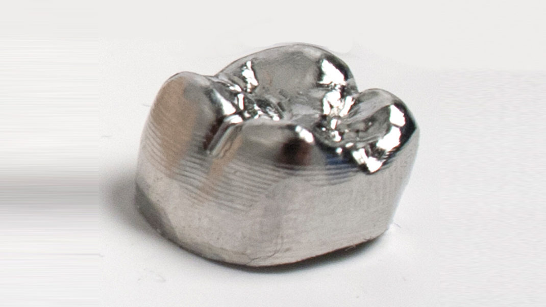 a full metal dental crown