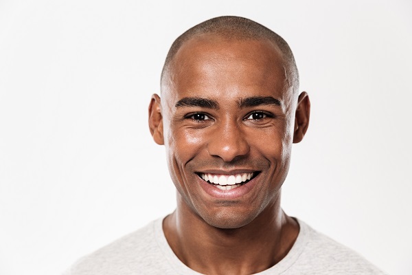 a man with veneers smiling