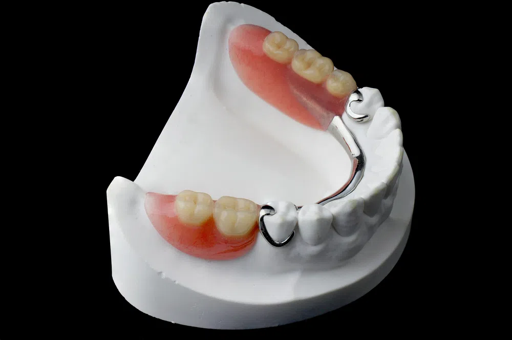 metal framework partial dentures